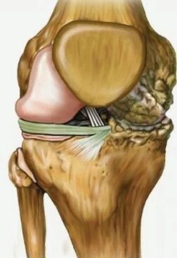 Knee joints