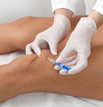 Ozone therapy