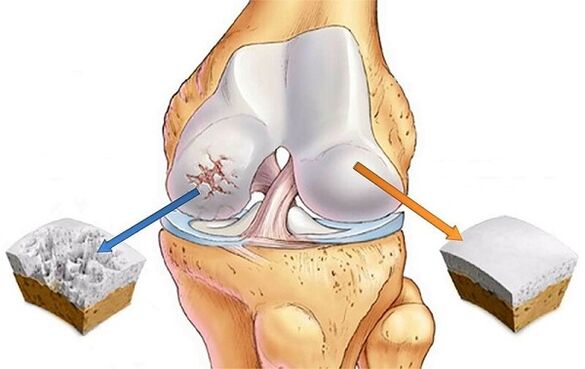 Standards and deviations of knee joint joints