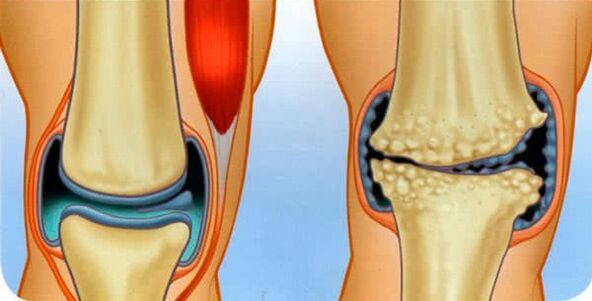 The normal joint condition and the reasons for joint development of the knee joint