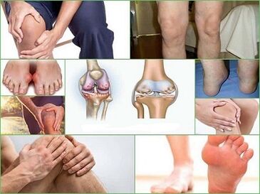 How to prevent the development of arthritis and arthritis