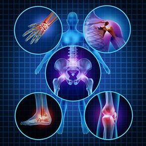 How to promote joint mobility in arthritis and arthritis in treatment