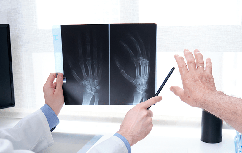 Diagnosis of joint disease