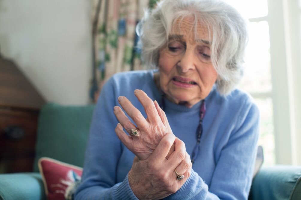 Hand joint arthritis of an elderly woman